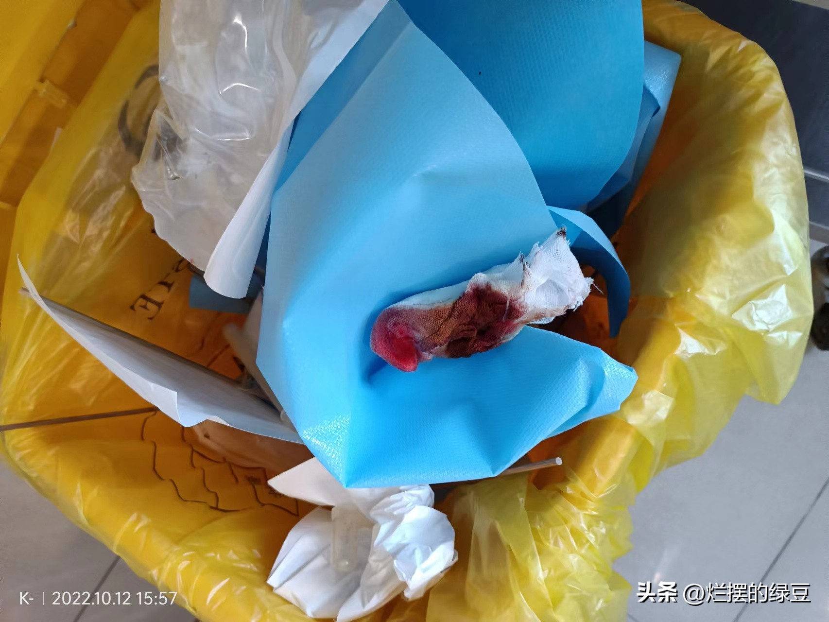 医院检查没事的心情说说,去医院检查是什么心情