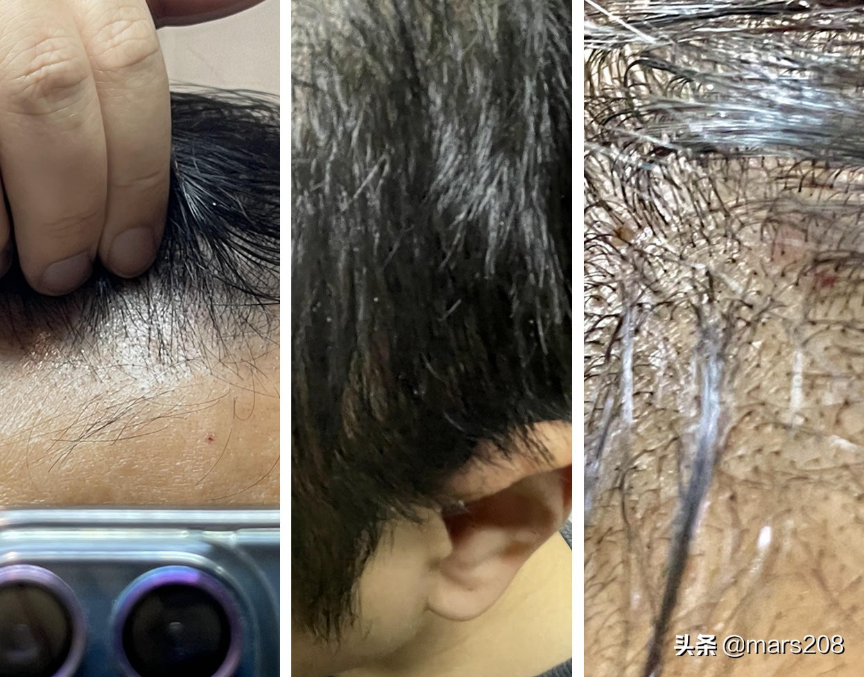 修护受损发质防脱洗发水推荐,防脱头发最好的洗发水