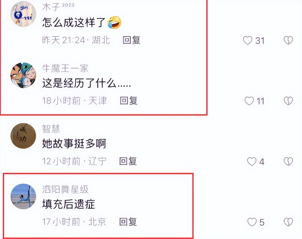 佟丽娅也整容失败了？面色憔悴面容沧桑，法令纹突出眼袋能挂酱油