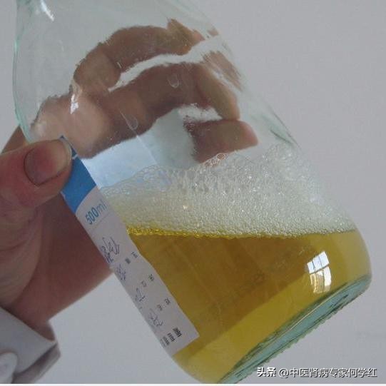 中医中药治疗尿蛋白,中药治疗尿蛋白主要的是哪些中药