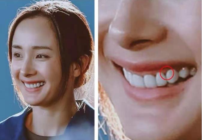 烤瓷牙的明星,烤瓷牙的明星都有谁