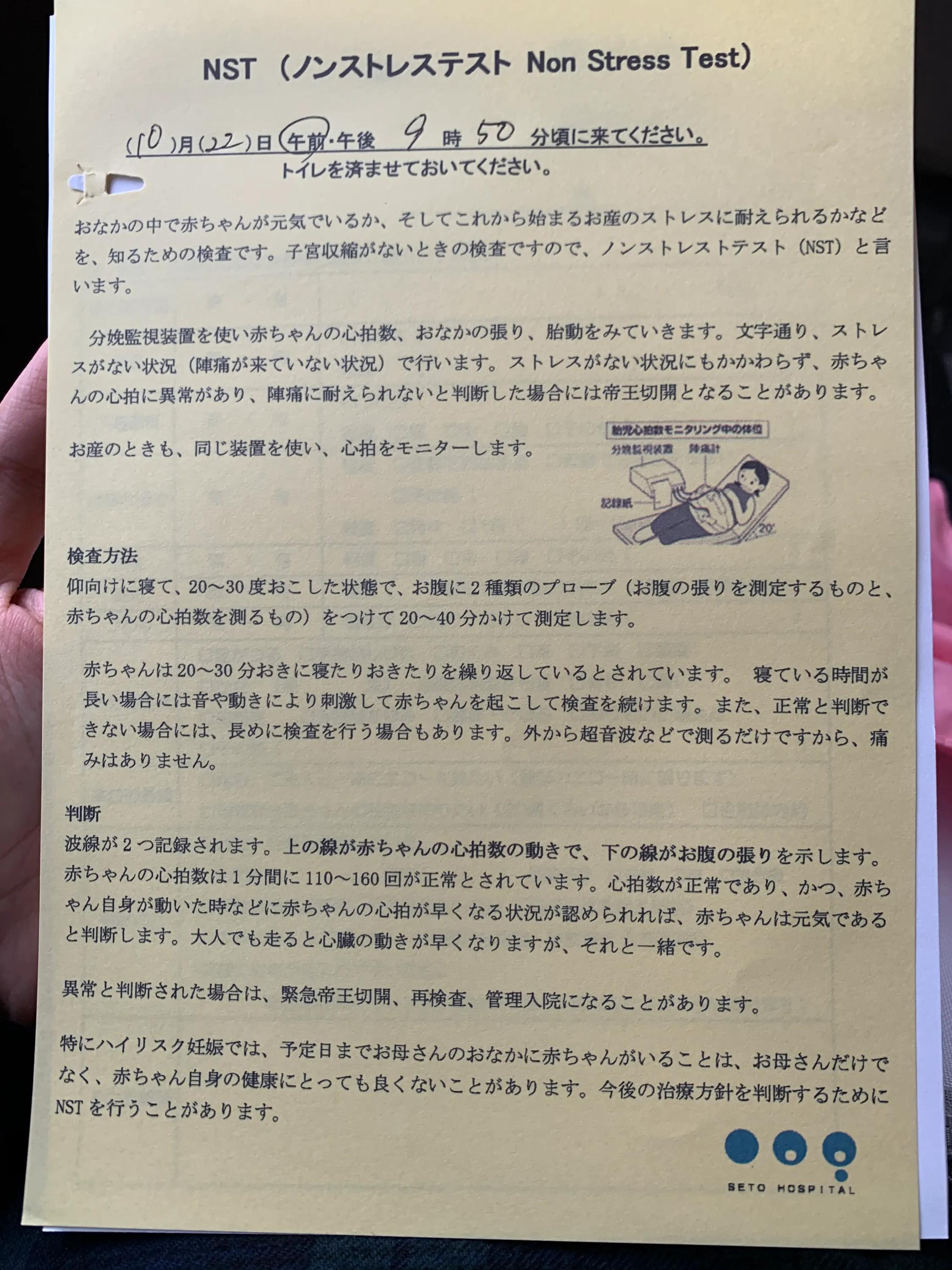 日本产检真实感受,在日本做产检的体验