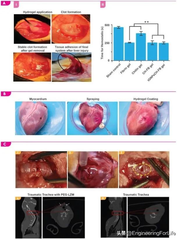 《AM》综述：对具有抗菌性能生物粘合剂的深度剖析