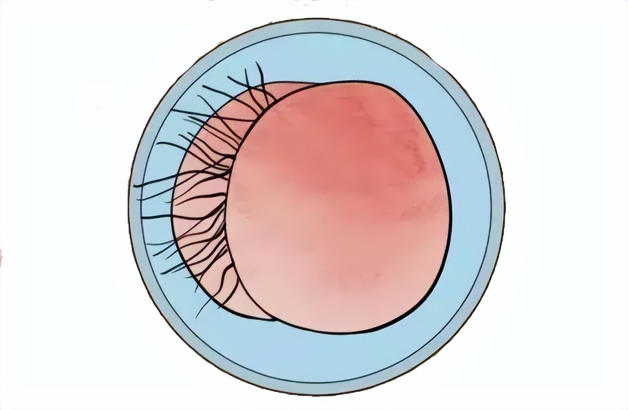 菊花痒到坐立难安?可能是肛毛太多惹的祸