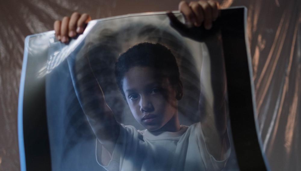 突破性算法改变游戏规则：儿童结核病防治迎来曙光