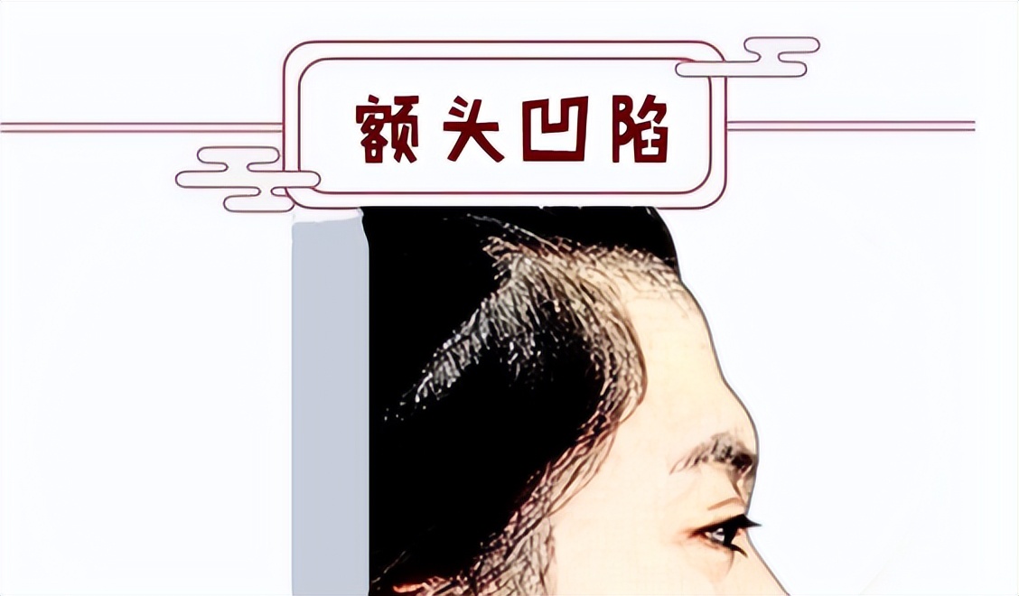 江苏苏王整形怎么样,苏王医疗整形做提眉怎么样