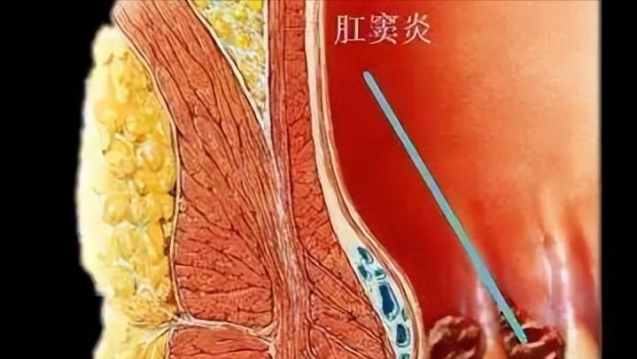 你有洗屁股的习惯吗,你有洗屁屁的习惯吗