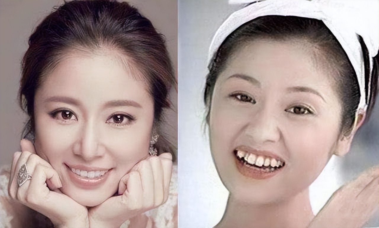 垫屁垫，烤瓷牙，戴美瞳：这些女明星的修修补补，看得人眼花缭乱