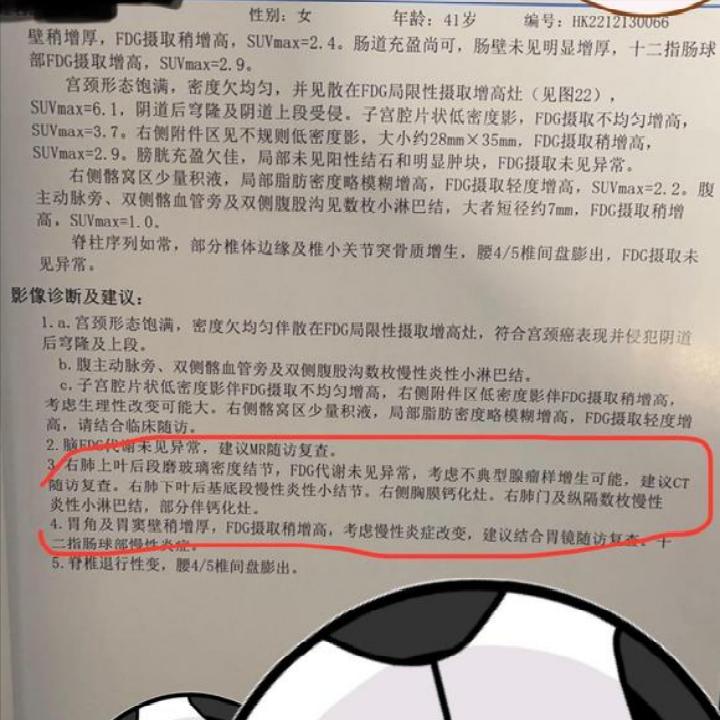 宫颈癌术后肺磨玻璃结节,宫颈癌或者癌前病变