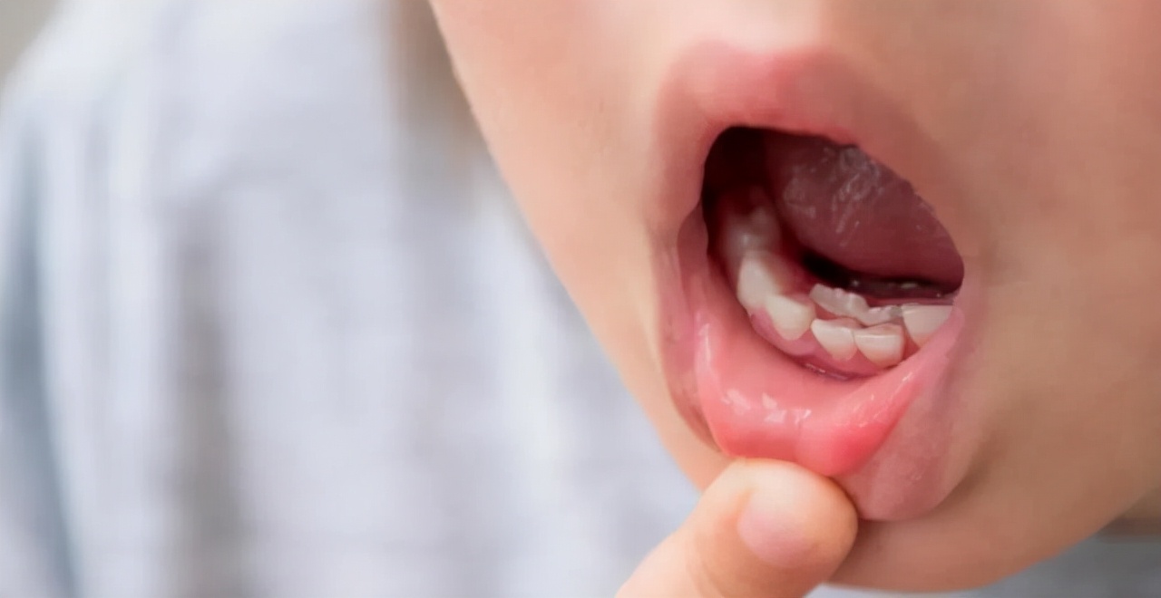 孩子什么时候换牙？避开三个忽视，遵循三要点，换牙情况早知道