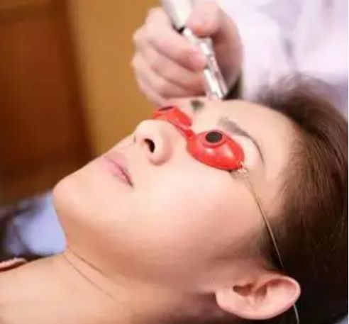 激光洗眉毛之后正确护理方法,激光点阵的正确护理方法