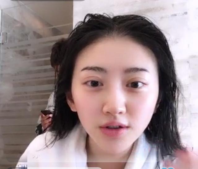 女子割双眼皮失败像瞪眼,女明星割双眼皮对比照