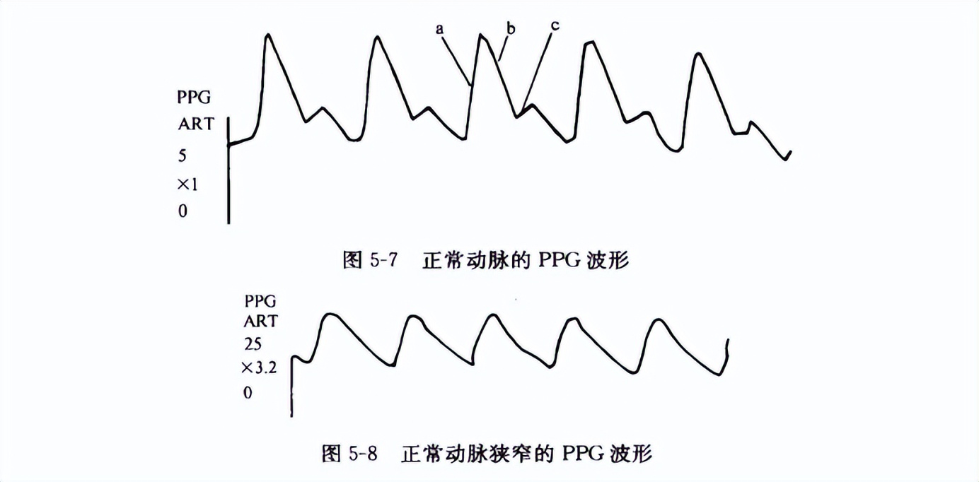有关血管外科学的书推荐,血管外科临床解剖学第2版