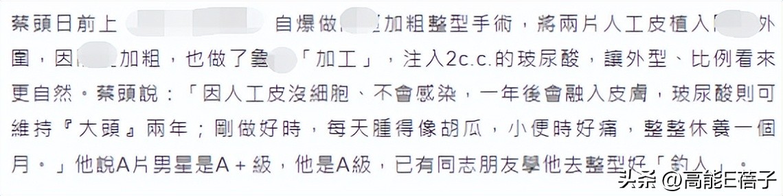 台湾艺人整形记：削骨换脸小场面，嫁给医师保修终身