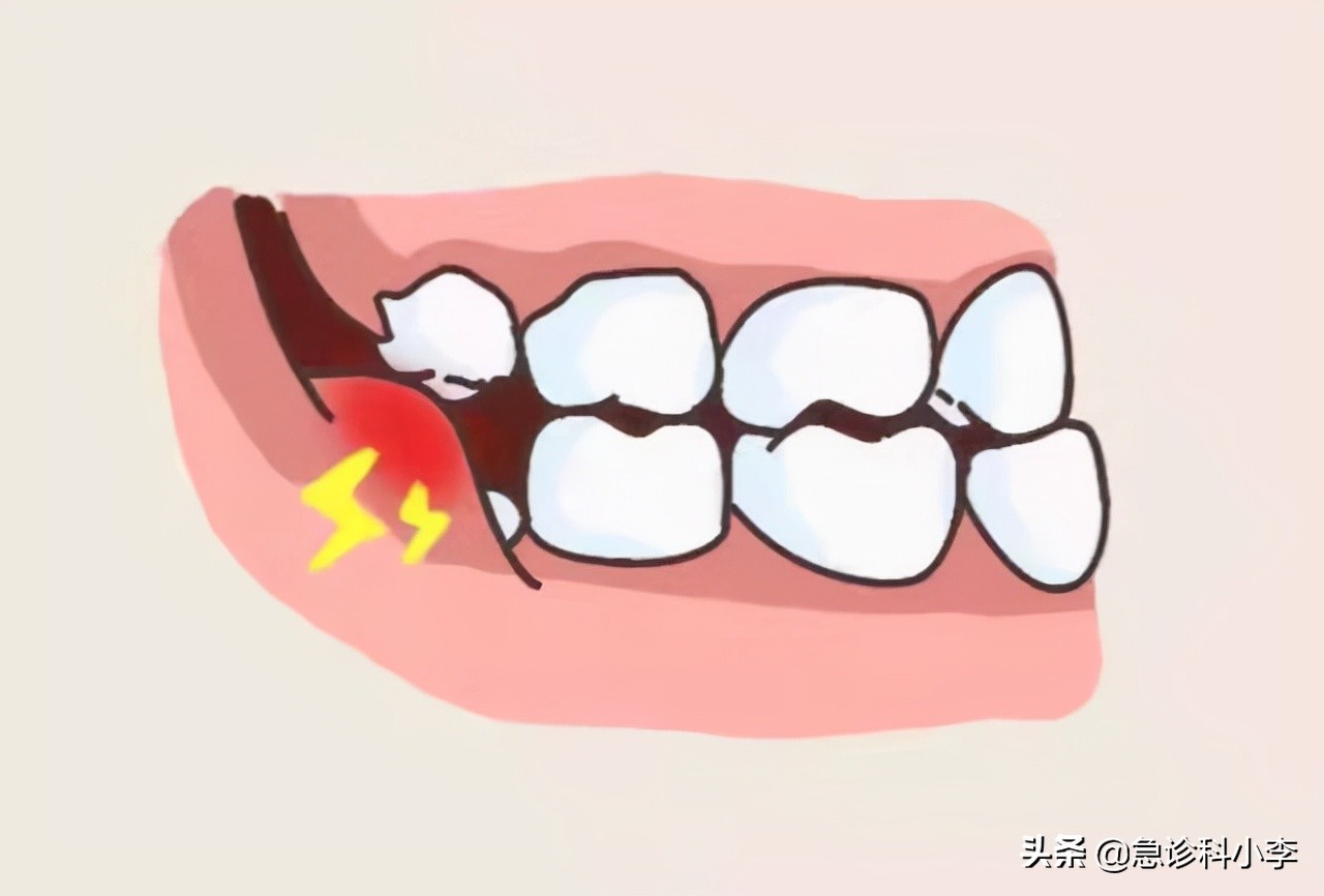 甲硝唑专治什么病,甲硝唑治什么病最有效