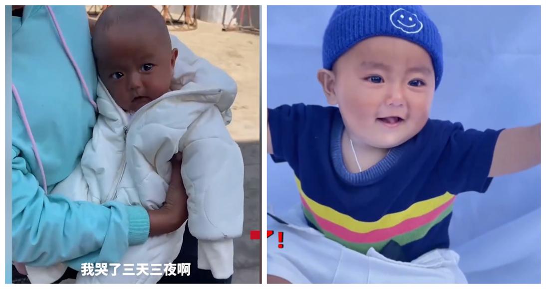 妈妈怀孕爱喝可乐，宝宝出生黑成“酱油色”，耐心抚养后惊喜逆袭