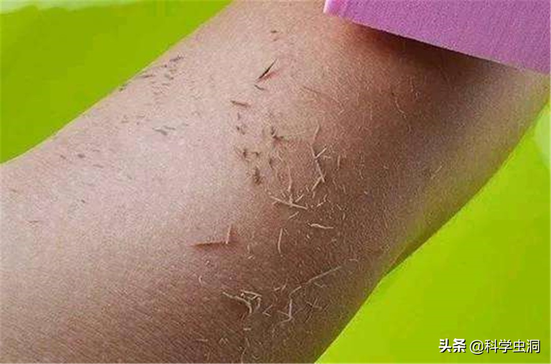 洗澡搓下来的黑泥到底是什么？显微镜放大100倍，画面不忍直视