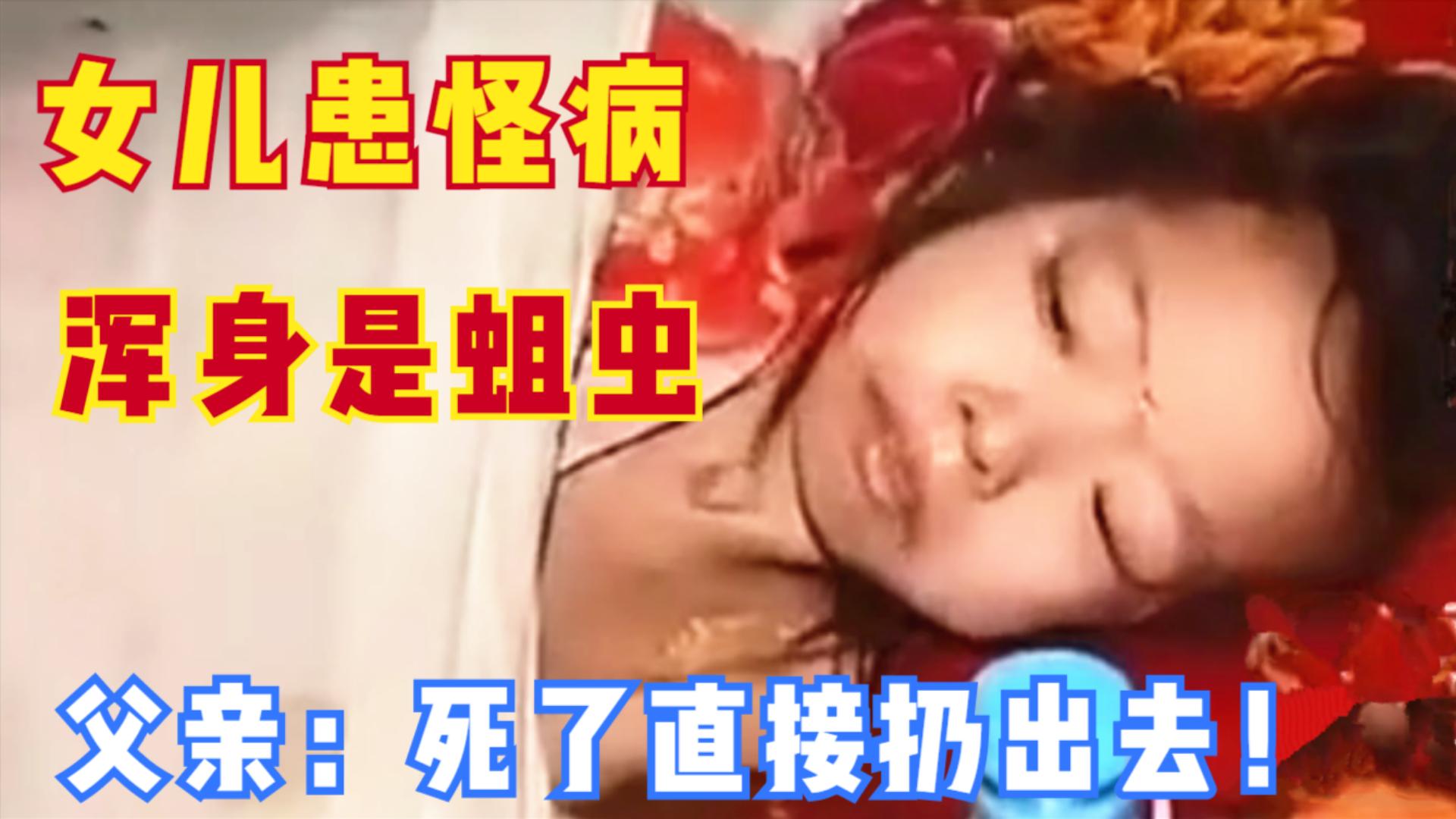 浑身有蛆虫的女孩被救活了吗,10岁女孩身上长蛆虫的病