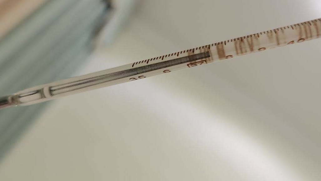 高烧反复，退烧药无效？医生从膀胱取出好多磁力珠，家长要当心了