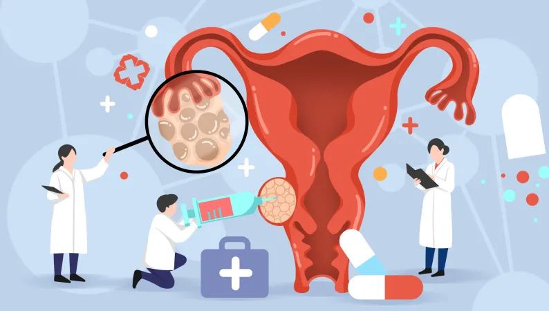 科普|为何大姨妈总是提前驾到？分清原因很重要