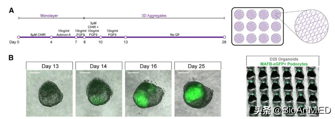 高通量体外类器官平台助力多囊肾病新药研发