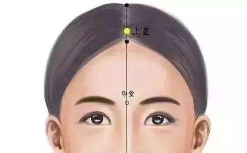 头部脑供血不足穴位,头部穴位针灸的作用