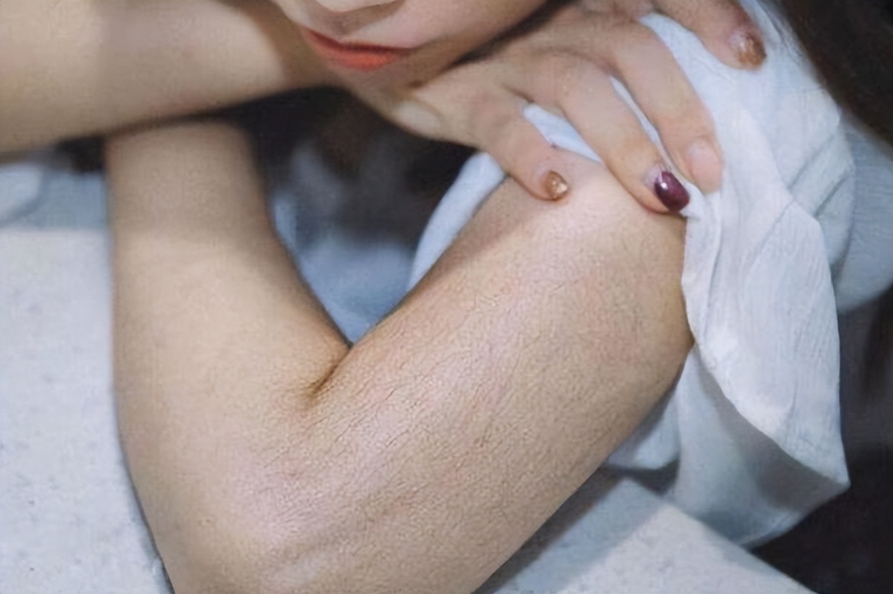 体毛旺盛和体毛稀疏的区别,女性体毛越来越少是什么原因造成