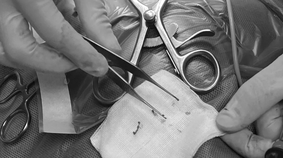 狗狗颈椎椎间盘突出导致前肢瘫痪,狗狗颈椎骨质增生压迫神经怎么办