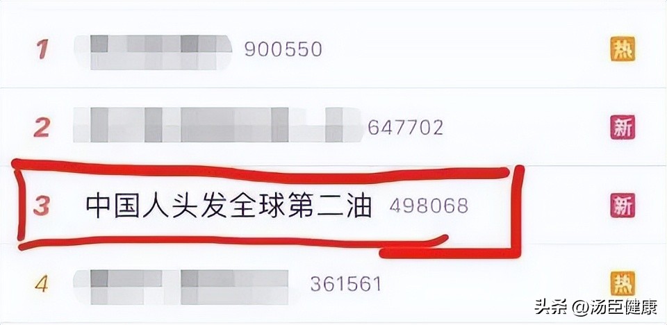 昨天洗的头今天就臭了怎么办,昨天洗了头今天就很油