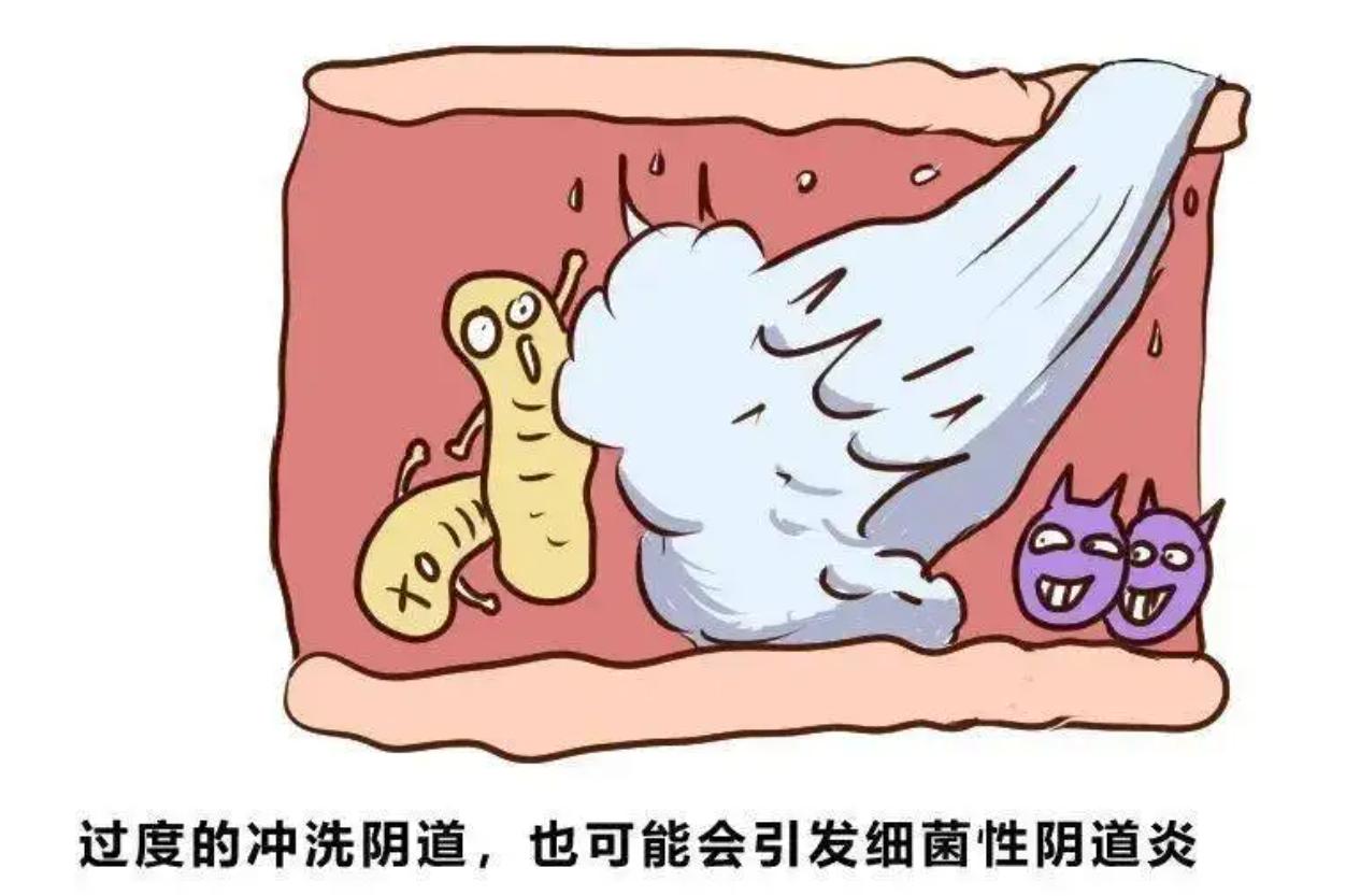 阴道炎瘙痒没完没了！有了傅青主这个方子，数月便可让炎症消失