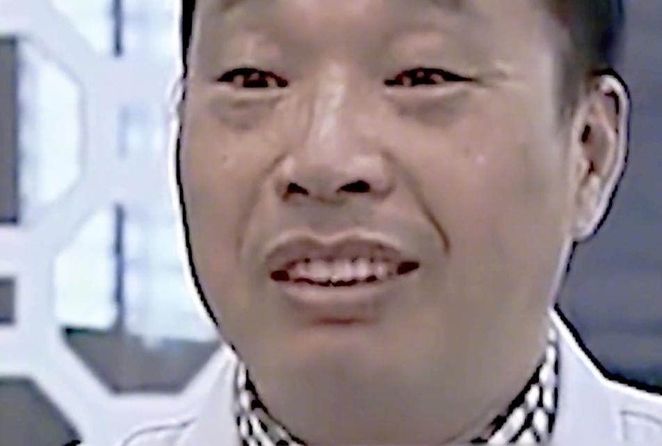 50岁大爷查不出五脏六腑,50岁大爷去体检找不到器官