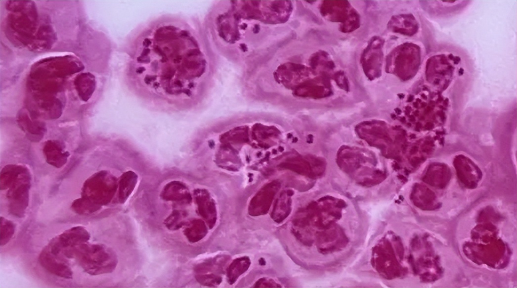 公共厕所马桶细菌对女性的危害,公共卫生间马桶有细菌吗