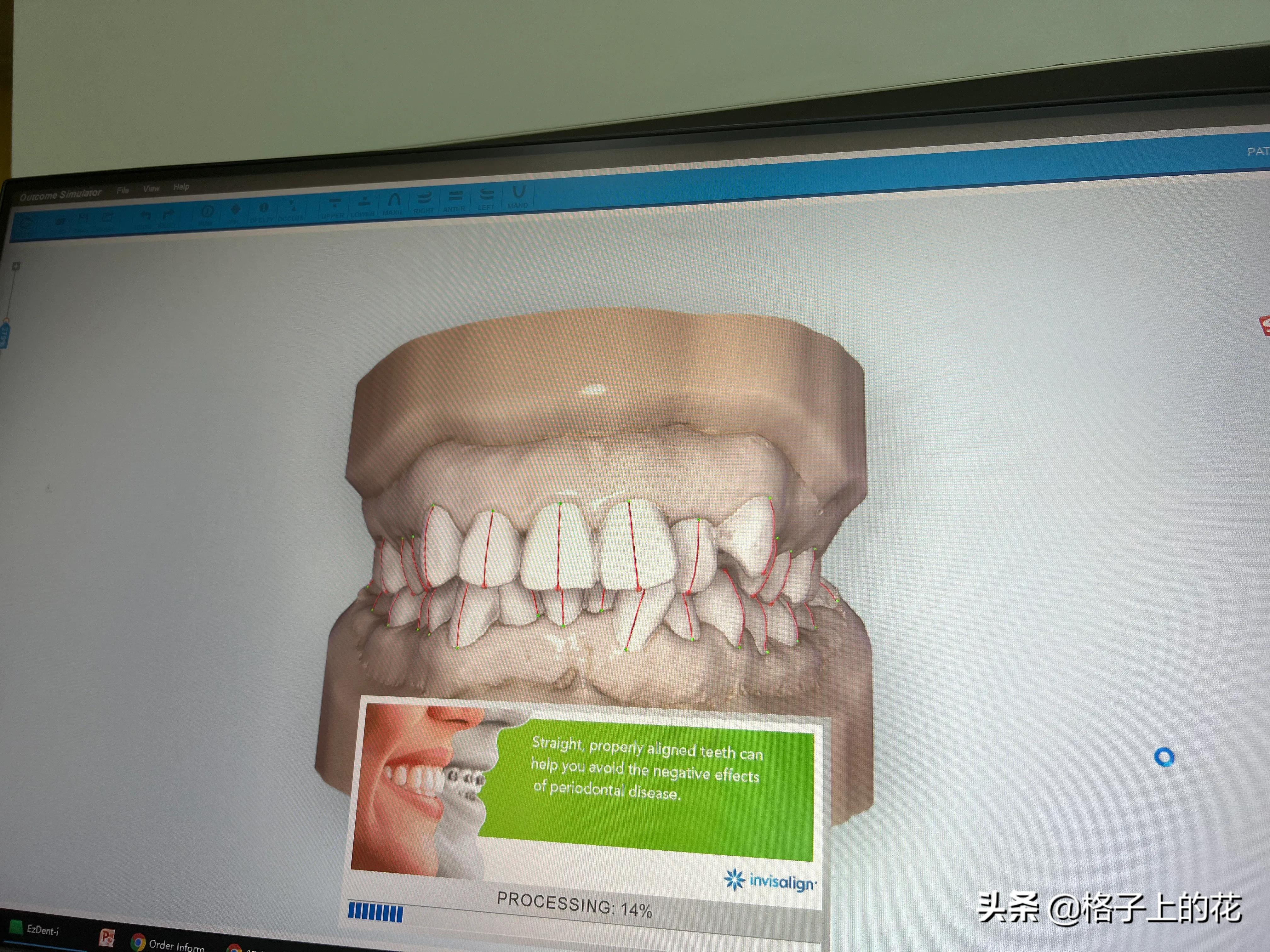 广州市正规的口腔医院,广州比较正规的口腔医院