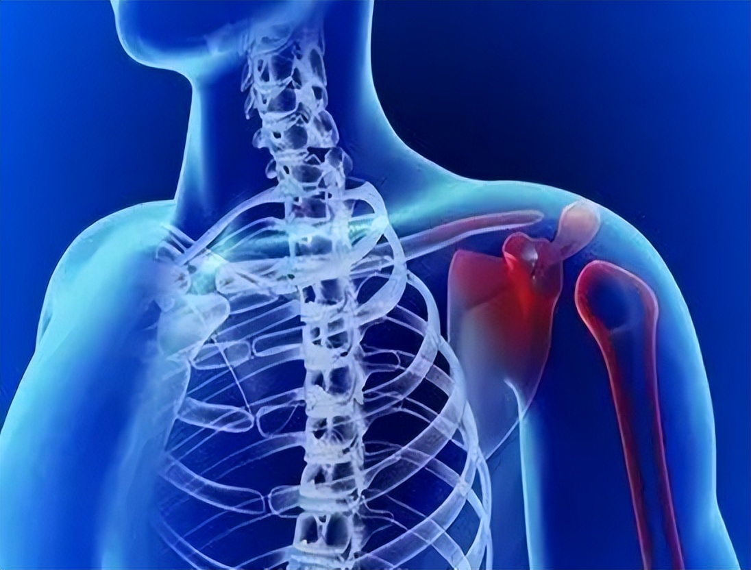 肩膀疼痛是怎么回事？本文告知您9种病因，让您再也不盲目咨询