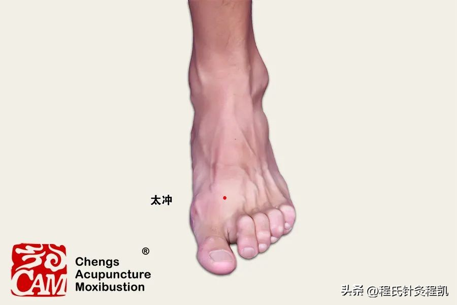 程凯养生说专栏荨麻疹,程凯养生说手麻原因