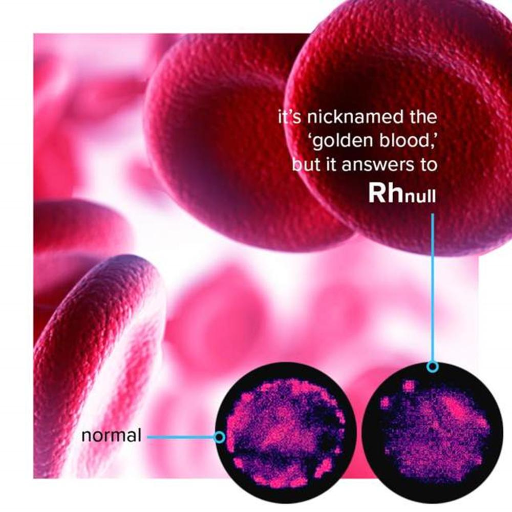 熊猫血稀有血型排行榜,比熊猫血还稀有的血型