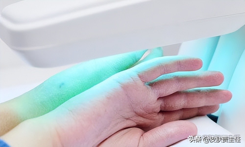 读完这篇文章，让你知道银屑病到底是什么，如何科学地来治疗