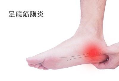 足底筋膜炎脚抬高非常疼,足底筋膜炎引起的脚疼怎么办