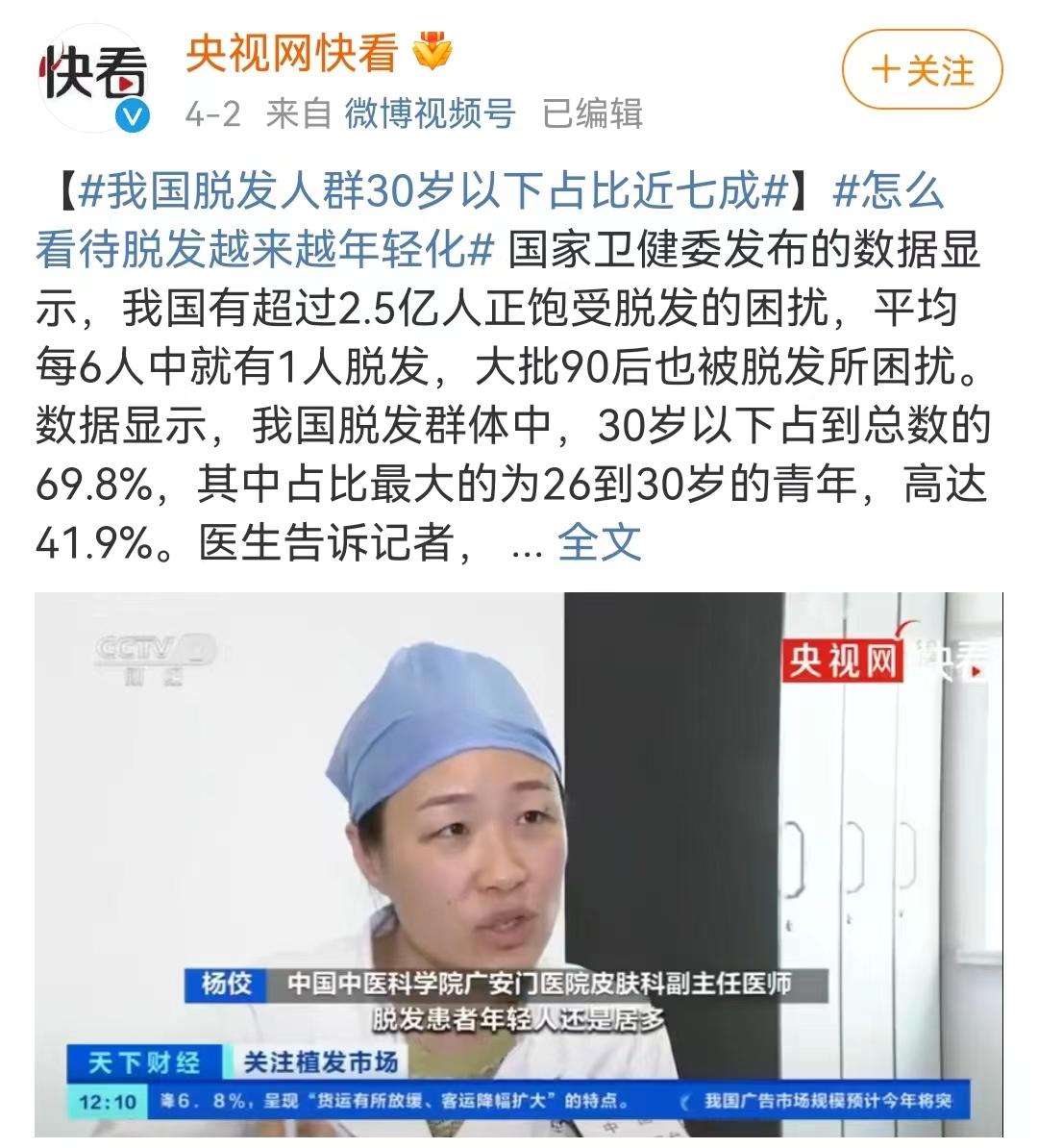华西招募脱发临床志愿者,华西医院脱发志愿者