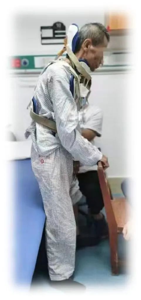 挑战骨折康复,颈椎如果摔断了会有什么后果