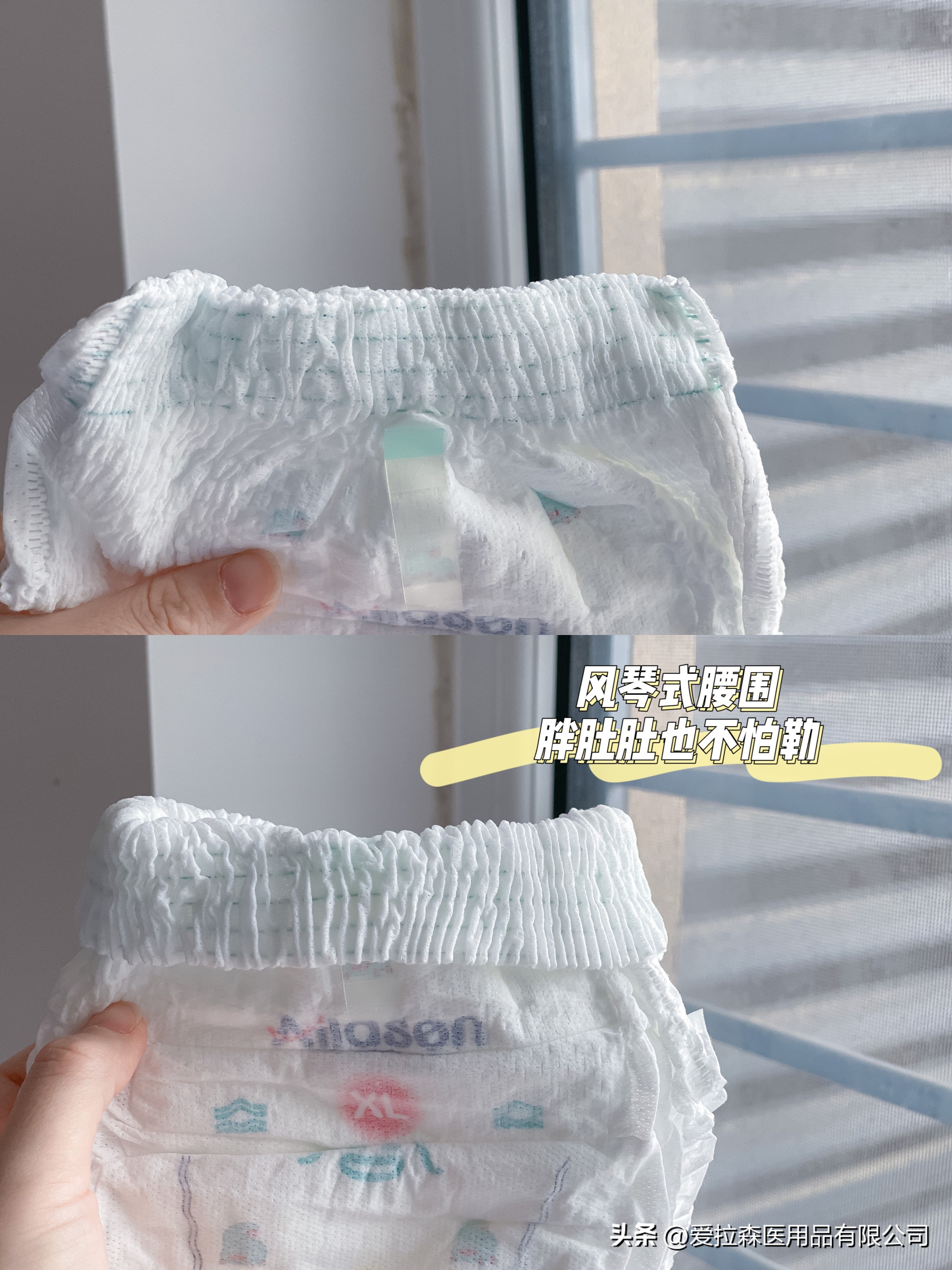 腰部有勒痕的地方总是起一大片包,腰部有勒痕是怎么回事