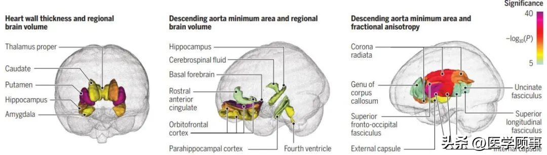 心脏不健康的指标,大脑和心脏有哪些危害