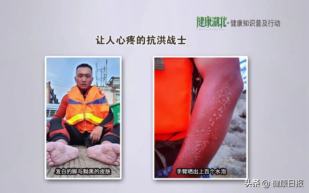 皮肤病的问题全在这里,皮肤病的10大问题