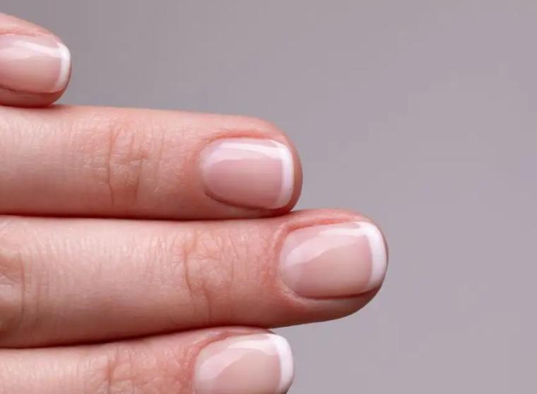 指甲出现异常是肝上出问题了吗,口苦口臭指甲竖纹是肝的问题吗