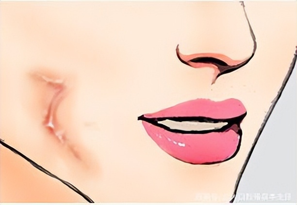 疤痕科普系列之解读疤痕的种类,疤痕的种类及最新治疗方法