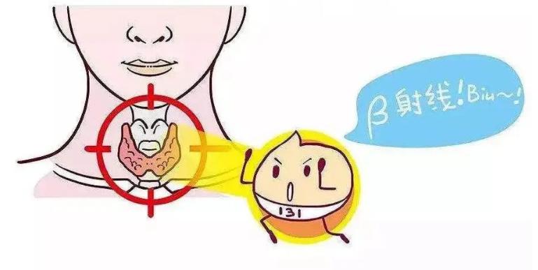 碘131治疗患者自述,甲亢患者治愈分享