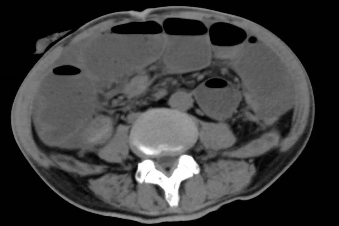 积水潭医院新龙泽院区急诊,北京积水潭医院骨科新龙泽院区