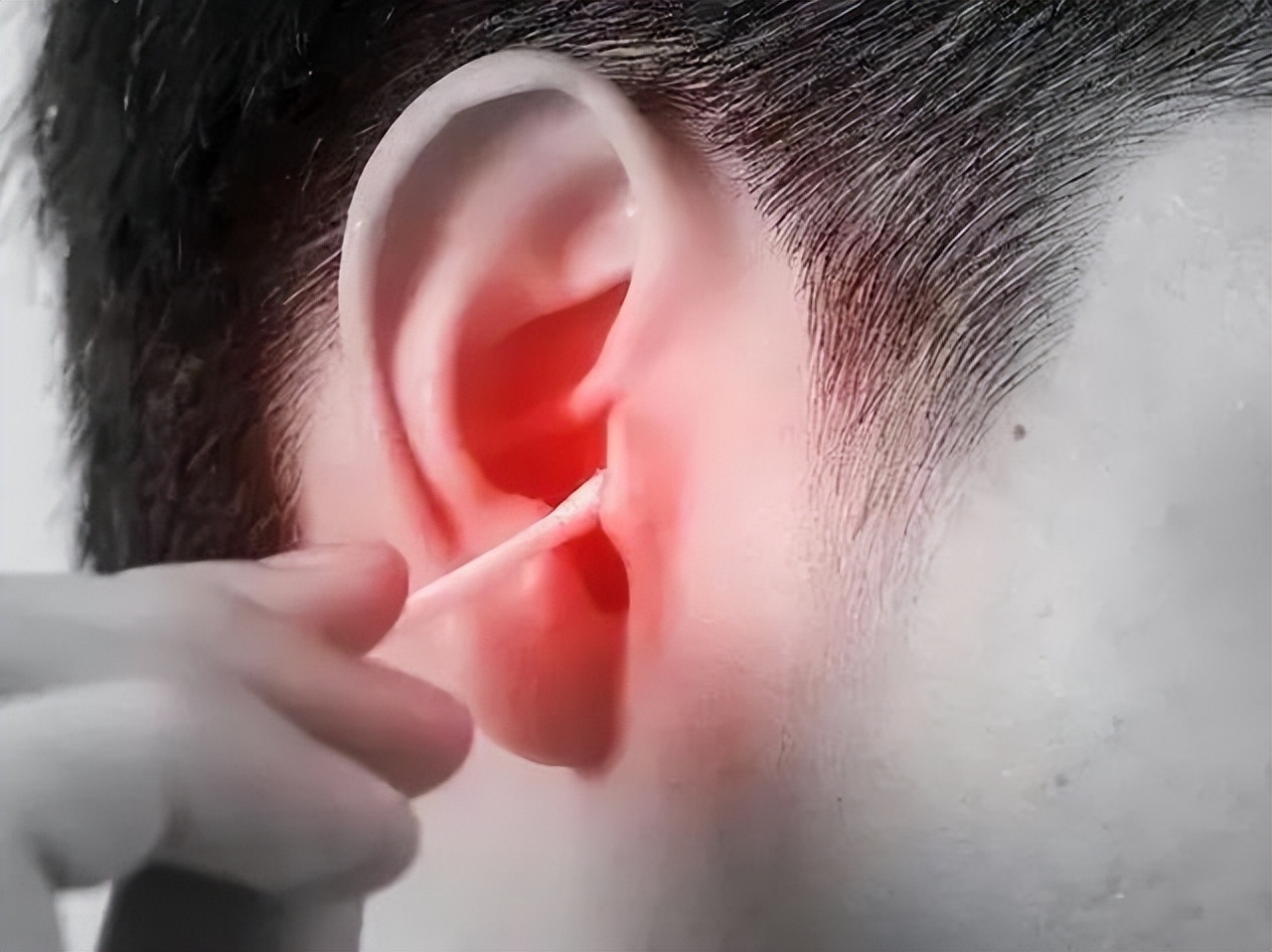 耳朵痒却掏不出任何东西中医辨证,耳朵特别痒又掏不出耳屎怎么办