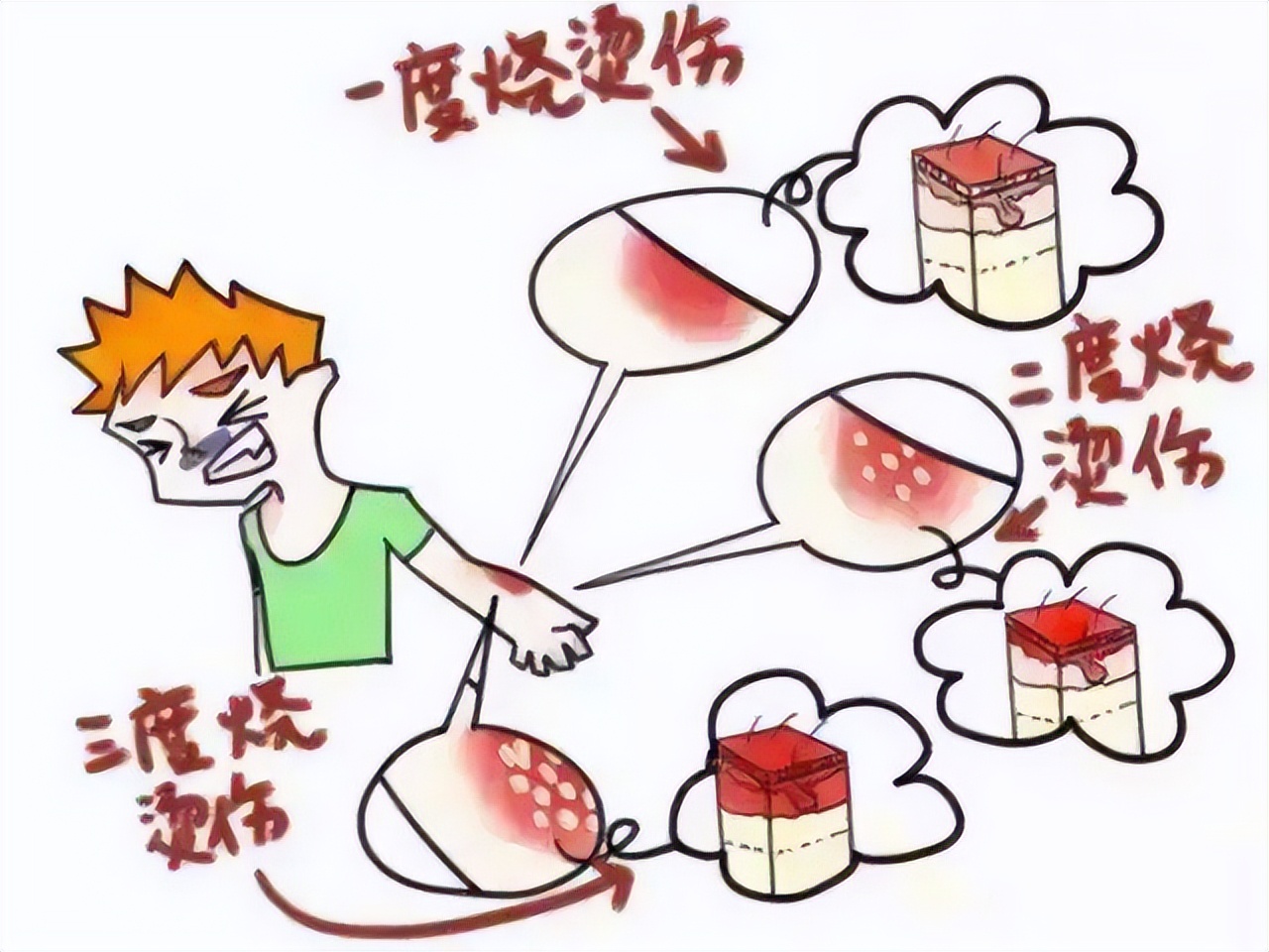 科普疤痕知多少,瘢痕科普视频