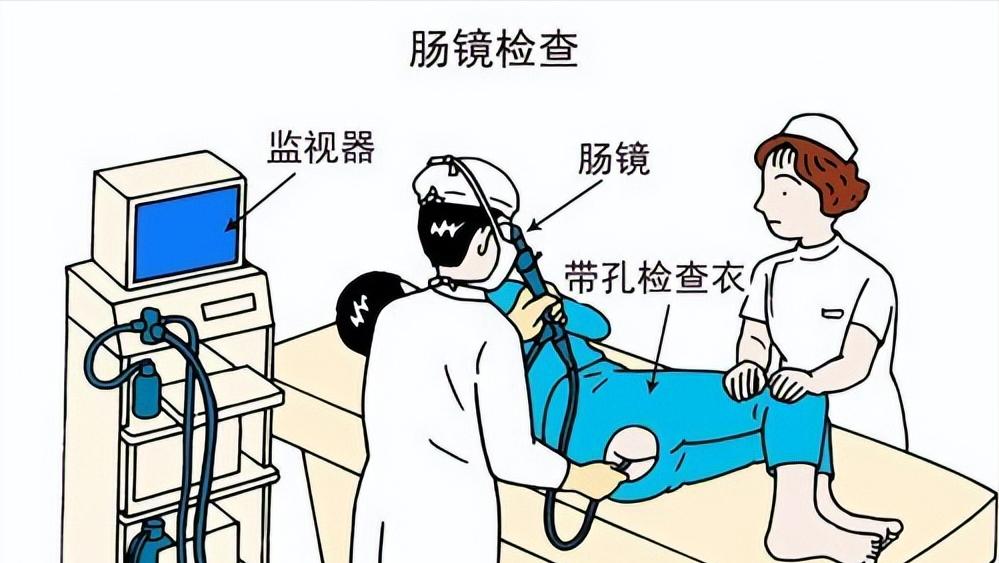 什么情况下医生才建议做肠镜,做过无痛肠镜后身体有什么症状